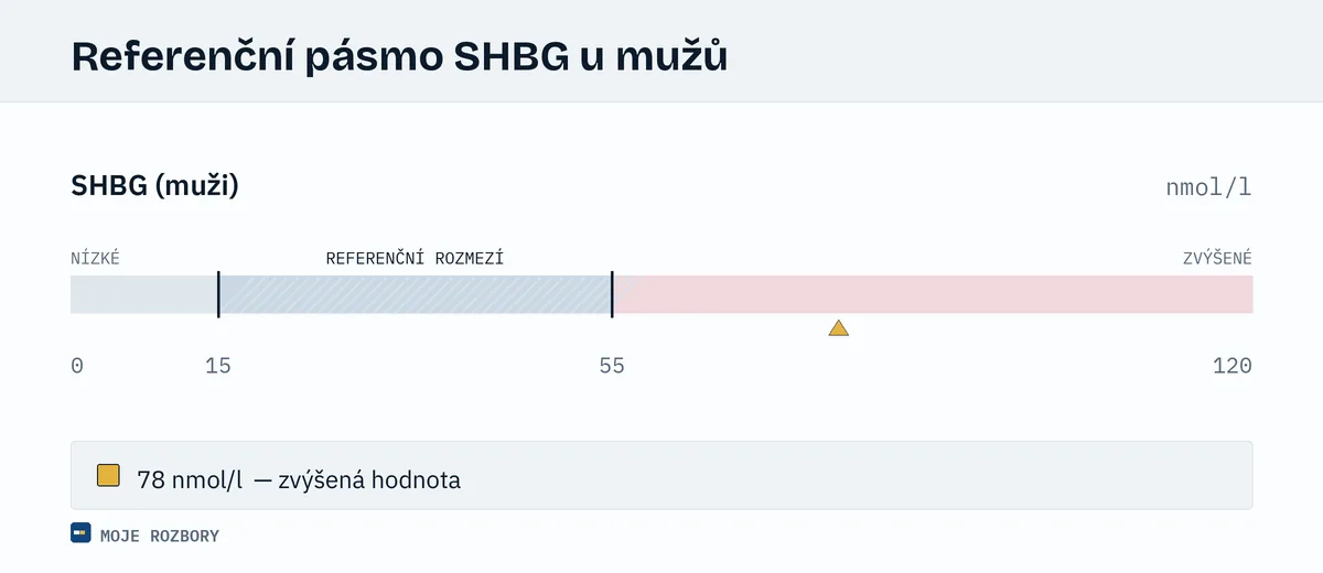 Grafické znázornění orientačního referenčního pásma SHBG u dospělých mužů